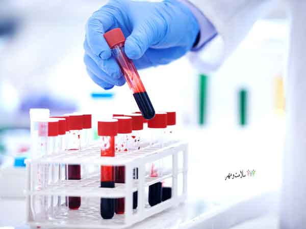 بازتاب شیوه زندگی در 160 پروتئین مختلف موجود در خون انسان 