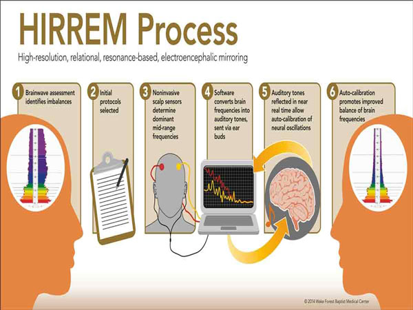 درمان جدید اختلال استرس پس از سانحه با (HIRREM ) امکان درک سیگنال های الکتریکی مغز در ذهن بیمار 
